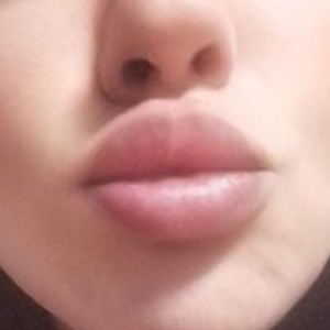anet2000