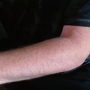 hairyversil